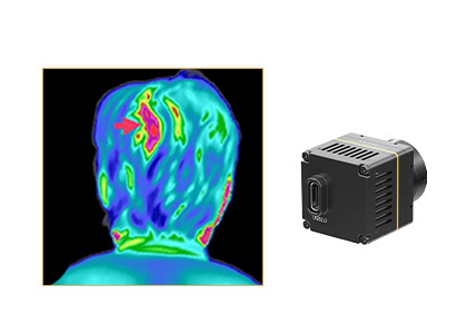 Uncooled 384x288/17μm Thermal Module for Medical Thermal Image Screening